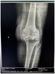 PREOP